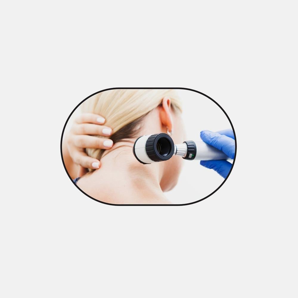 Dermatoscope - Image 3